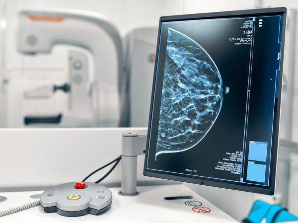 Mammography