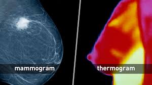 Is Thermography as good as mammography?